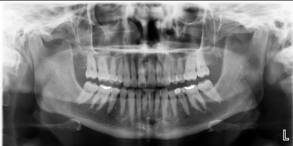 Precision 2D Reports