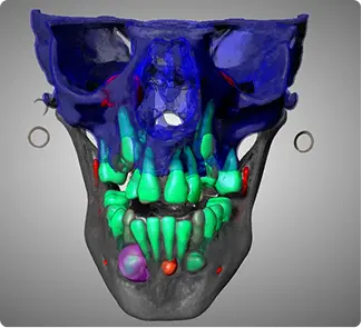 Skull Scan Blue