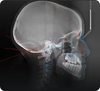 Head Profile Scan