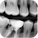 Intraoral 2D Series