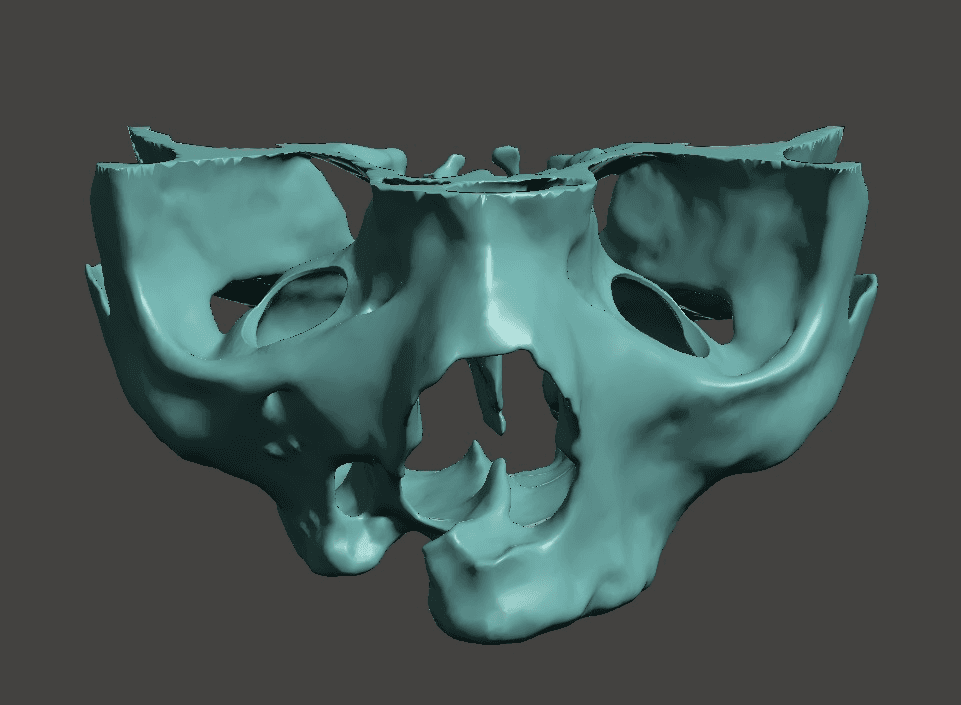 Single model segmentation